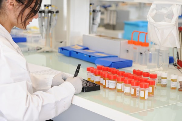 Analyse urine